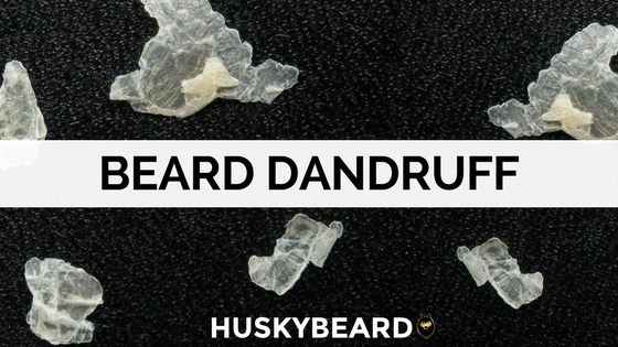 How to Get Rid of Beard Dandruff